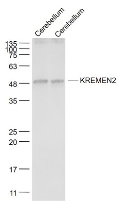 KREMEN2 Rabbit anti-Human, Polyclonal, Bioss 100 &mu;L; Unconjugated:Antibodies,