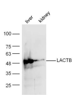 LACTB Rabbit anti-Human, Polyclonal, Bioss 100 &mu;L; Unconjugated:Antibodies,