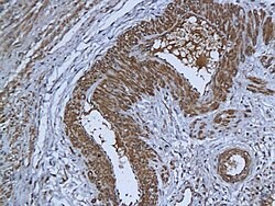 DAPK3 Rabbit anti-Human, Polyclonal, Bioss 100 &mu;L; Unconjugated:Antibodies,