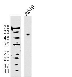 DAPK3 Rabbit anti-Human, Polyclonal, Bioss 100 &mu;L; Unconjugated:Antibodies,