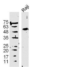 DAPK3 Rabbit anti-Human, Polyclonal, Bioss 100 &mu;L; Unconjugated:Antibodies,