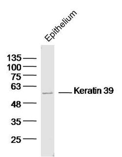 Keratin 39 Rabbit anti-Human, Polyclonal, Bioss 100 &mu;L | Buy Online | Bioss | Fisher Scientific