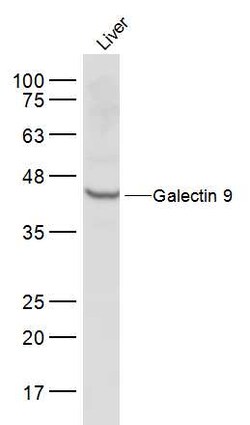 Galectin 9 Rabbit anti-Human, Polyclonal, Bioss 100 &mu;L; Unconjugated:Antibodies,