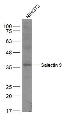 Galectin 9 Rabbit anti-Human, Polyclonal, Bioss 100 &mu;L; Unconjugated:Antibodies,