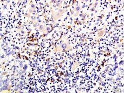 pan Cytokeratin Rabbit anti-Human, Polyclonal, Bioss 100 &mu;L; Unconjugated:Antibodies,