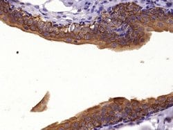 pan Cytokeratin Rabbit anti-Human, Polyclonal, Bioss 100 &mu;L; Unconjugated:Antibodies,