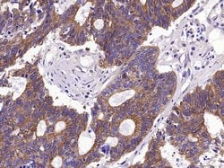 pan Cytokeratin Rabbit anti-Human, Polyclonal, Bioss 100 &mu;L; Unconjugated:Antibodies,
