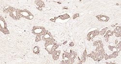 pan Cytokeratin Rabbit anti-Human, Polyclonal, Bioss 100 &mu;L; Unconjugated:Antibodies,