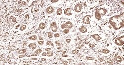 pan Cytokeratin Rabbit anti-Human, Polyclonal, Bioss 100 &mu;L; Unconjugated:Antibodies,