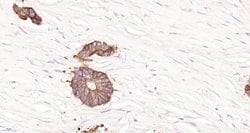 pan Cytokeratin Rabbit anti-Human, Polyclonal, Bioss 100 &mu;L; Unconjugated:Antibodies,