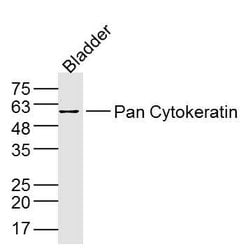 pan Cytokeratin Rabbit anti-Human, Polyclonal, Bioss 100 &mu;L; Unconjugated:Antibodies,