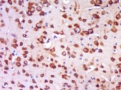 TRIT1 Rabbit anti-Human, Polyclonal, Bioss 100 &mu;L; Unconjugated:Antibodies,