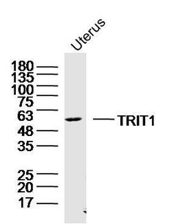 TRIT1 Rabbit anti-Human, Polyclonal, Bioss 100 &mu;L; Unconjugated:Antibodies,