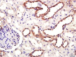 DAT/Dopamine transporter Rabbit anti-Human, Polyclonal, Bioss 100 &mu;L;