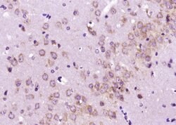 DAT/Dopamine transporter Rabbit anti-Human, Polyclonal, Bioss 100 &mu;L;