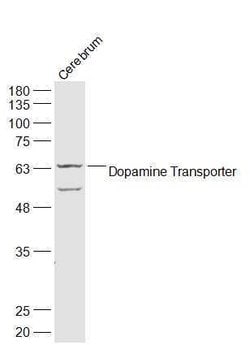 DAT/Dopamine transporter Rabbit anti-Human, Polyclonal, Bioss 100 &mu;L;