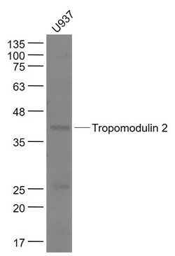 Tropomodulin 2 Rabbit anti-Human, Polyclonal, Bioss 100 &mu;L; Unconjugated:Antibodies,