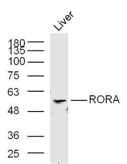 RORA Rabbit anti-Human, Polyclonal, Bioss 100 &mu;L | Buy Online | Bioss | Fisher Scientific