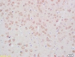 Phospho-TPH2 (Ser19) Rabbit anti-Human, Polyclonal, Bioss 100 &mu;L; Unconjugated:Antibodies,