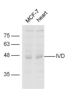 IVD Rabbit anti-Human, Polyclonal, Bioss 100 &mu;L; Unconjugated:Antibodies,