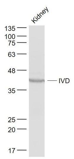 IVD Rabbit anti-Human, Polyclonal, Bioss 100 &mu;L; Unconjugated:Antibodies,