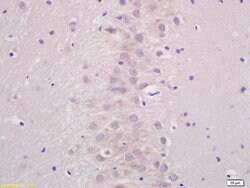 ATP7B Rabbit anti-Human, Polyclonal, Bioss 100 &mu;L; Unconjugated:Antibodies,