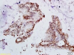HPV16 E6 + HPV18 E6 Rabbit anti-Virus, Polyclonal, Bioss 100 &mu;L; Unconjugated:Antibodies,