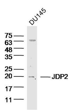 JDP2 Rabbit anti-Human, Polyclonal, Bioss 100 &mu;L; Unconjugated:Antibodies,