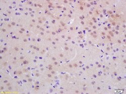 dUTPase Rabbit anti-Human, Polyclonal, Bioss 100 &mu;L; Unconjugated:Antibodies,