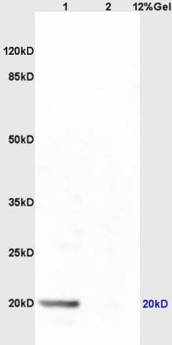 dUTPase Rabbit anti-Human, Polyclonal, Bioss 100 &mu;L; Unconjugated:Antibodies,