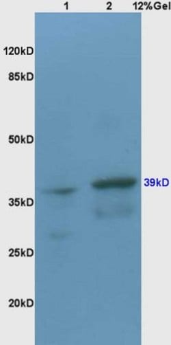 CX3CR1 Rabbit anti-Human, Polyclonal, Bioss 100 &mu;L; Unconjugated:Antibodies,