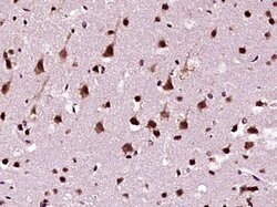 hnRNP DL Rabbit anti-Human, Polyclonal, Bioss 100 &mu;L; Unconjugated:Antibodies,