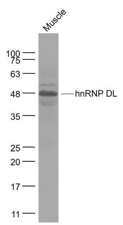 hnRNP DL Rabbit anti-Human, Polyclonal, Bioss 100 &mu;L; Unconjugated:Antibodies,