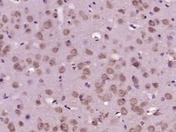 HPS5 Rabbit anti-Human, Polyclonal, Bioss 100 &mu;L; Unconjugated:Antibodies,