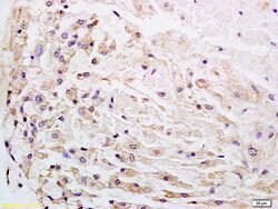 Wnt1 Rabbit anti-Human, Polyclonal, Bioss 100 &mu;L; Unconjugated:Antibodies,