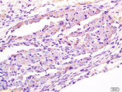 Wnt1 Rabbit anti-Human, Polyclonal, Bioss 100 &mu;L; Unconjugated:Antibodies,