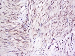 OTUD5 Rabbit anti-Human, Polyclonal, Bioss 100 &mu;L; Unconjugated:Antibodies,