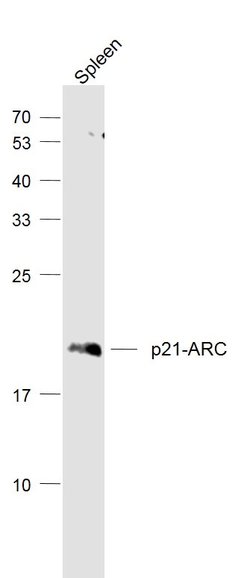 p21-ARC Rabbit anti-Human, Polyclonal, Bioss 100 &mu;L; Unconjugated:Antibodies,