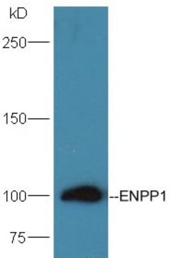 ENPP1/PC1/3 Rabbit anti-Human, Polyclonal, Bioss 100 &mu;L; Unconjugated:Antibodies,