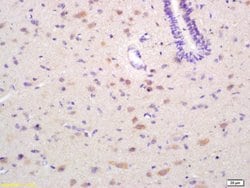 EPH receptor A4 Rabbit anti-Human, Polyclonal, Bioss 100 &mu;L; Unconjugated:Antibodies,