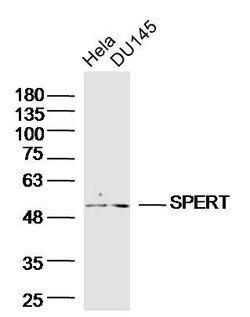 SPERT Rabbit anti-Human, Polyclonal, Bioss 100 &mu;L; Unconjugated:Antibodies,