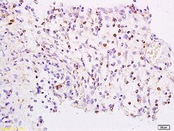 FOXJ1/HFH-4 Rabbit anti-Human, Polyclonal, Bioss 100 &mu;L; Unconjugated:Antibodies,