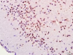 FOXJ1/HFH-4 Rabbit anti-Human, Polyclonal, Bioss 100 &mu;L; Unconjugated:Antibodies,