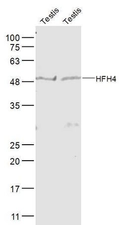 FOXJ1/HFH-4 Rabbit anti-Human, Polyclonal, Bioss 100 &mu;L; Unconjugated:Antibodies,