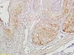 Gastrin receptor/GASR/CCKBR Rabbit anti-Human, Polyclonal, Bioss 100 &mu;L;