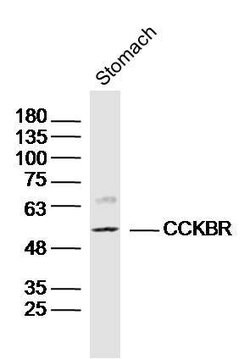 Gastrin receptor/GASR/CCKBR Rabbit anti-Human, Polyclonal, Bioss 100 &mu;L;