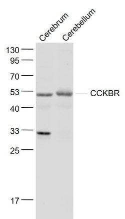 Gastrin receptor/GASR/CCKBR Rabbit anti-Human, Polyclonal, Bioss 100 &mu;L;