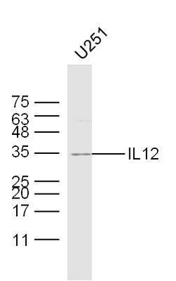 IL-12 Rabbit anti-Human, Polyclonal, Bioss 100 &mu;L; Unconjugated:Antibodies,