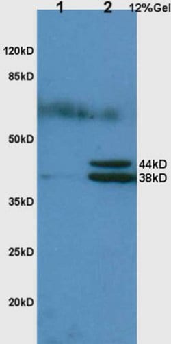 Hpt/Haptoglobin Rabbit anti-Human, Polyclonal, Bioss 100 &mu;L; Unconjugated:Antibodies,