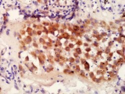 IRF9 Rabbit anti-Human, Polyclonal, Bioss 100 &mu;L; Unconjugated:Antibodies,